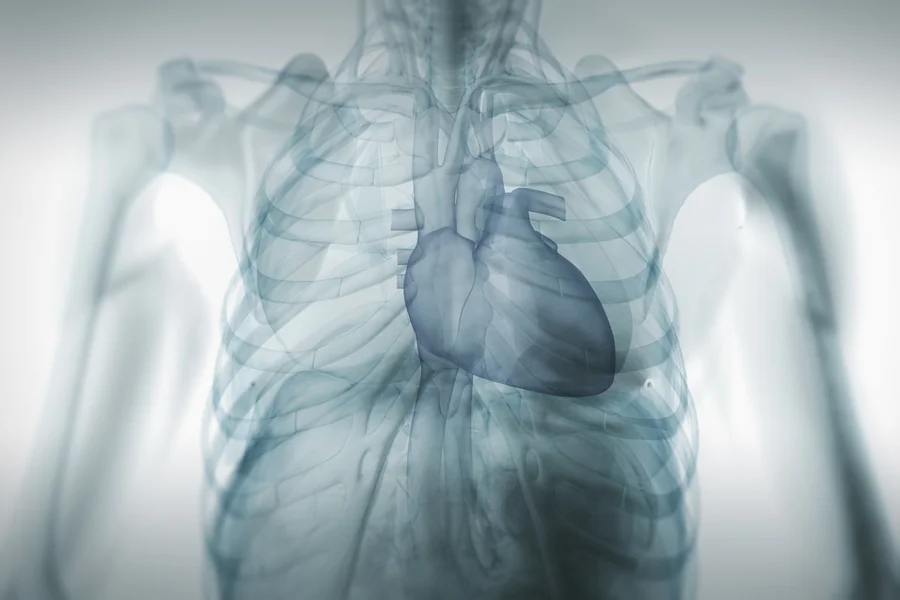 Left Atrial Enlargement: A Silent Threat to Heart Health?