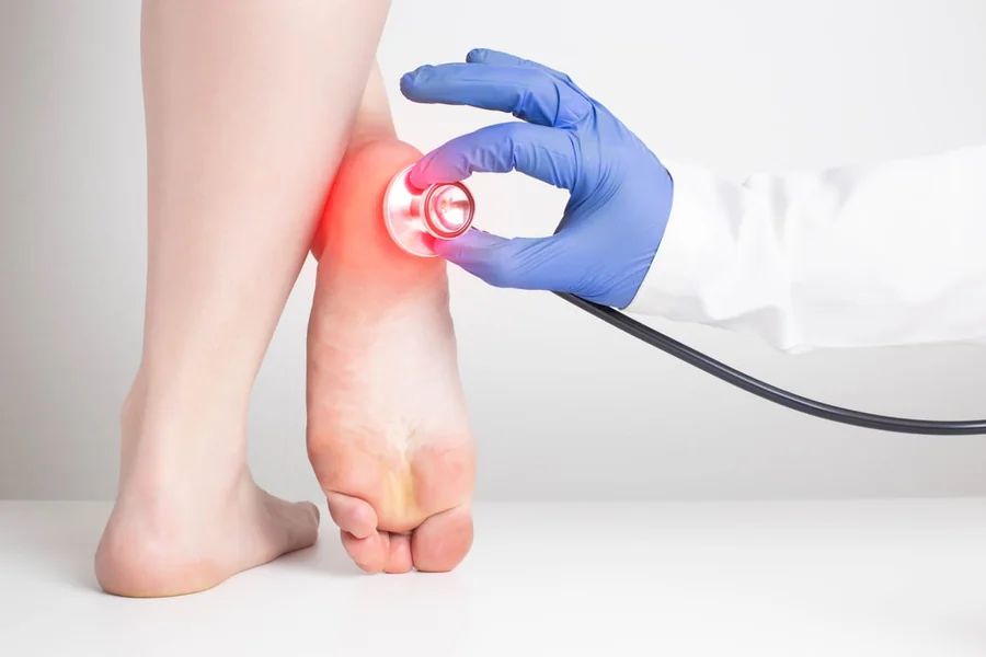 Diabetes Leg Pain: Everything You Need to Know
