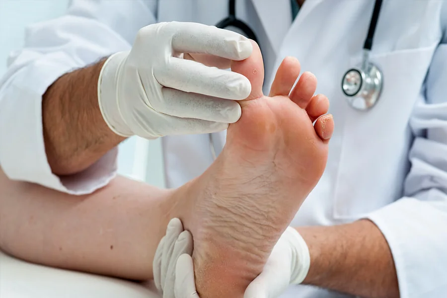 Diabetes Swollen Feet: Causes & Treatments