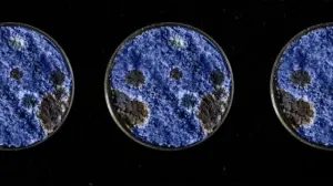 can mold cause leukemia