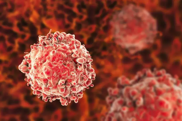 can mold cause leukemia